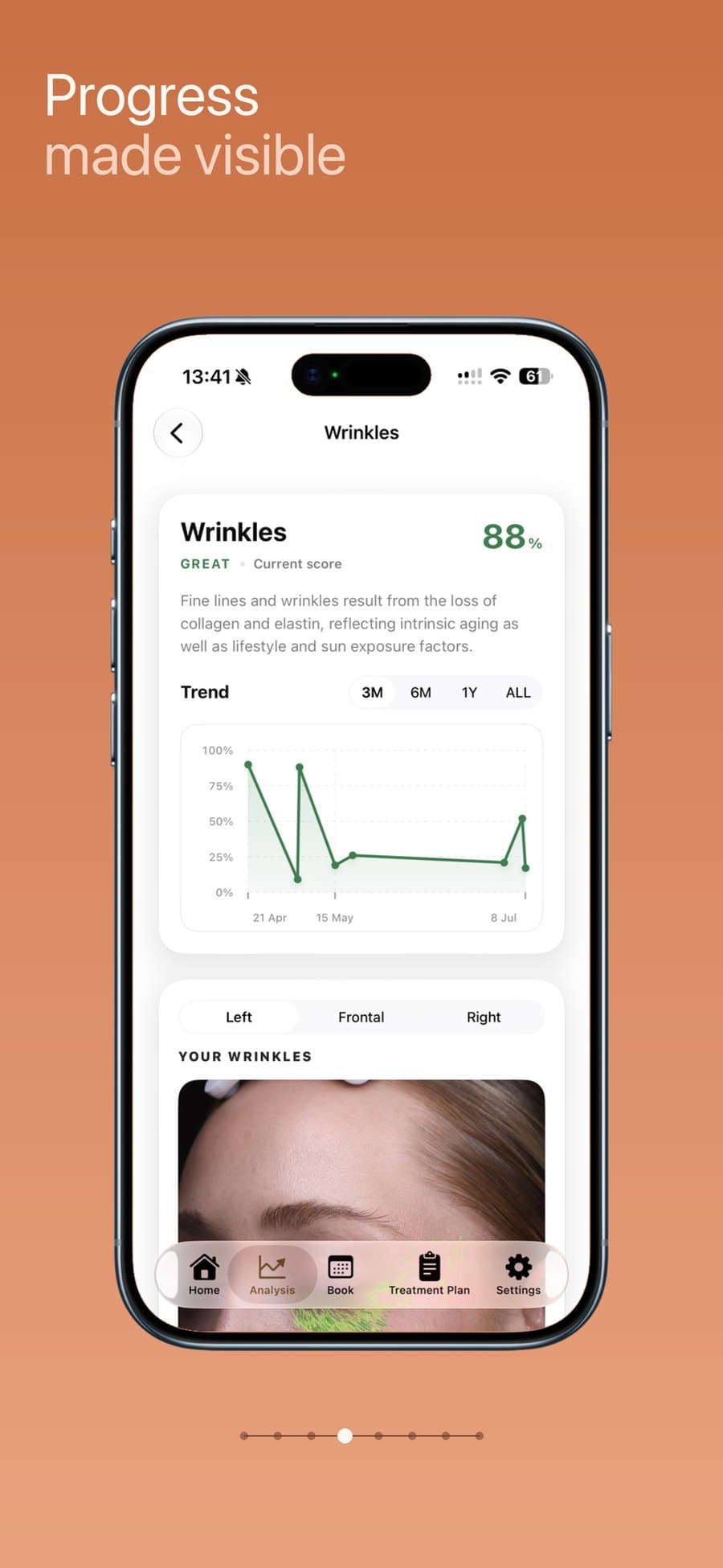 Wrinkles metric detail with a trend chart across past scans